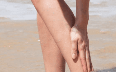 Stings from sea creatures
